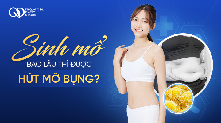 Sau Sinh Mổ Bao Lâu Mới Nên Hút Mỡ Bụng