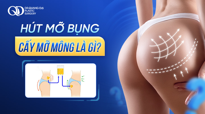 Hút Mỡ Bụng Cấy Mông Có An Toàn Không