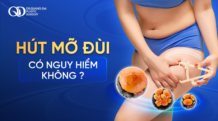 Hút mỡ đùi có nguy hiểm không