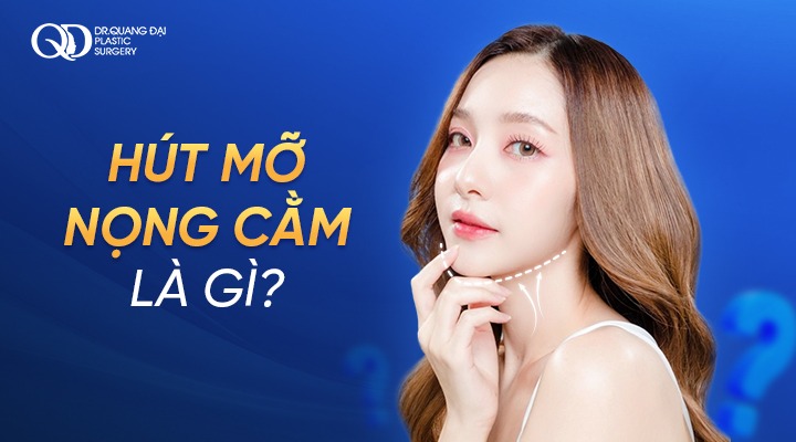 Hút mỡ nọng cằm