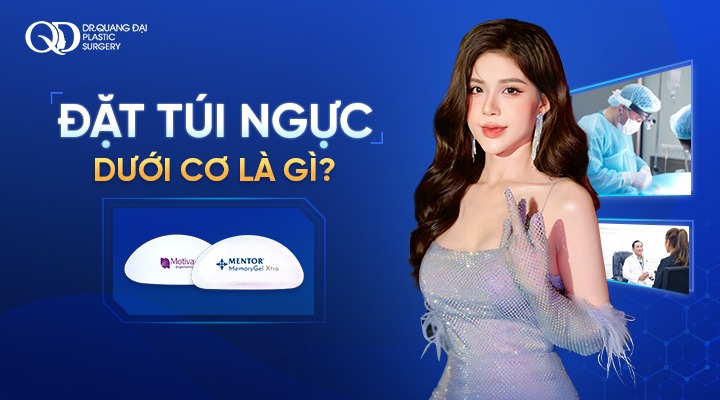 Đặt túi ngực dưới cơ