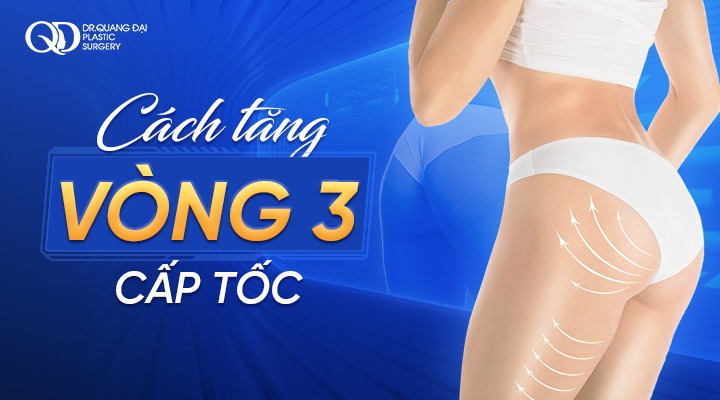 Nâng cấp vòng 3