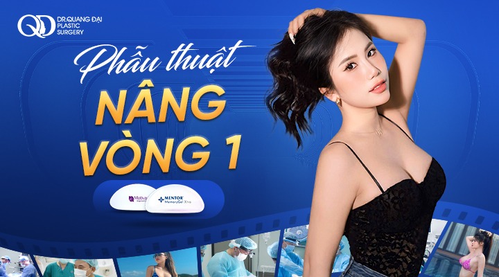 Phẫu thuật nâng vòng 1