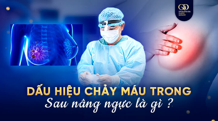 dấu hiệu chảy máu trong sau nâng ngực