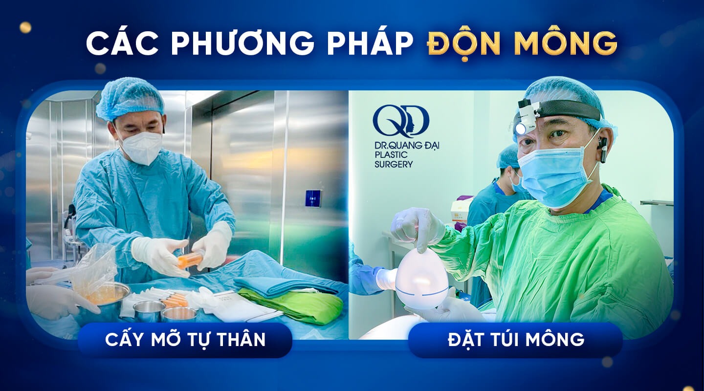 các phương pháp độn mông