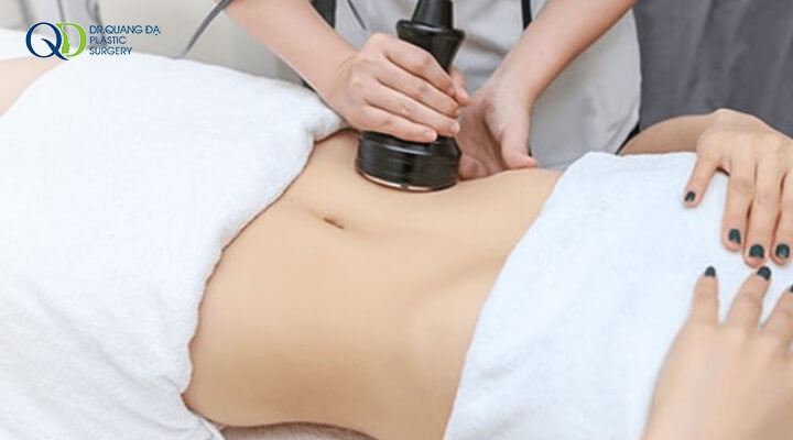 Hút mỡ bung không phẫu thuật