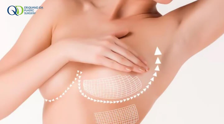 Nâng ngực không phẫu thuật có an toàn không