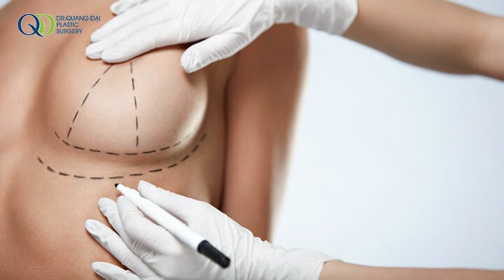 Nâng ngực uống trà sữa được không