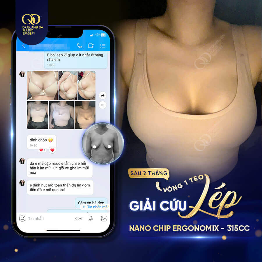 túi ngực ergonomix