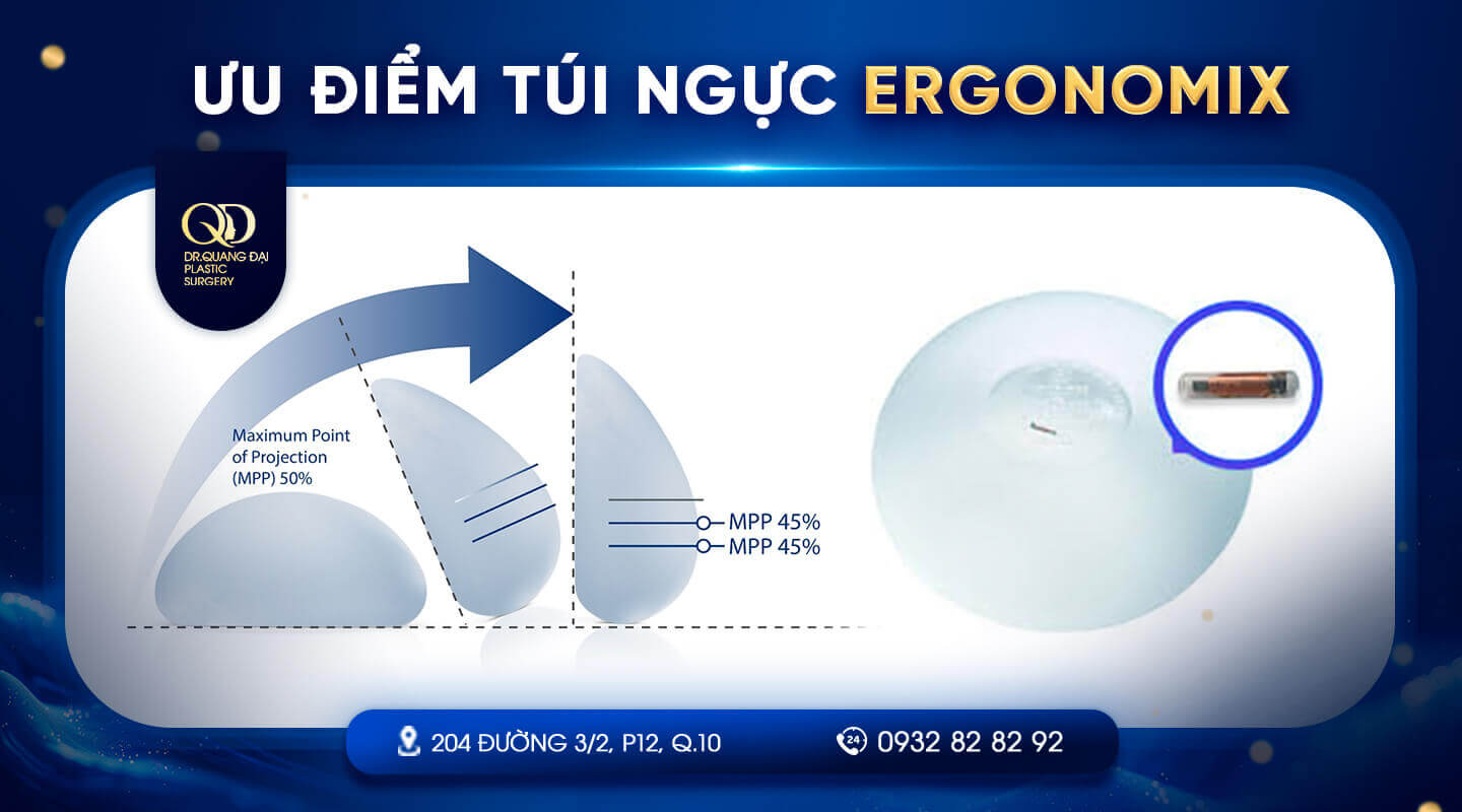 ưu điểm túi ngực ergonomix