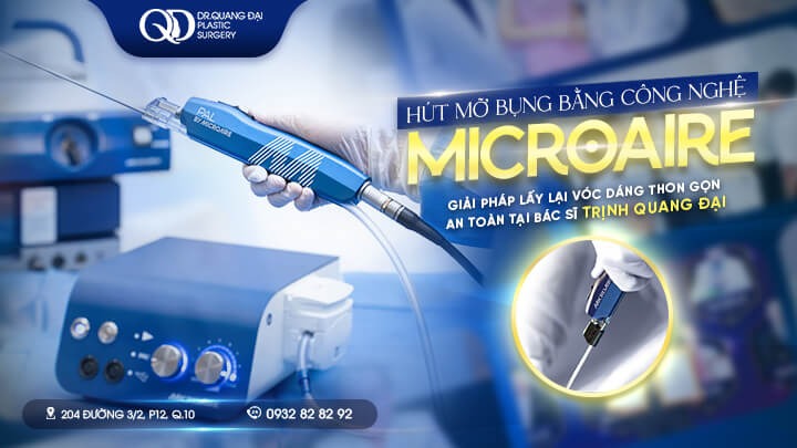 bác sĩ hút mỡ bụng