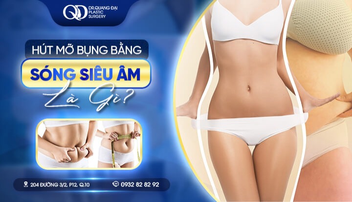 Hút mỡ bụng bằng sóng siêu âm