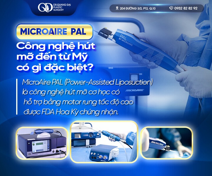 Hút mỡ bụng bằng sóng siêu âm