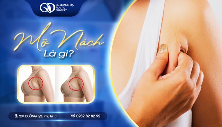 Hút mỡ nách