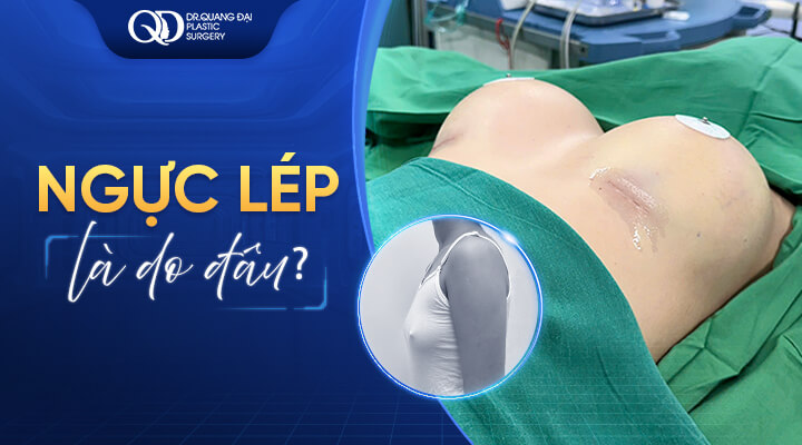 Ngực-lép-là-do-đâu