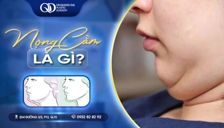 Nọng cằm là gì