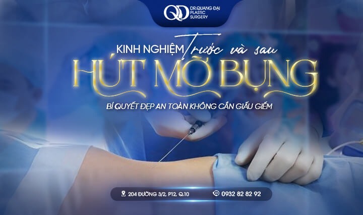 Kinh nghiệm hút mỡ bụng