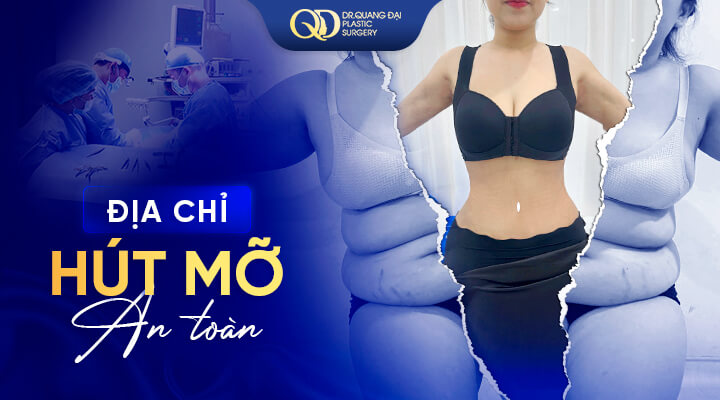 Hút-mỡ-bụng-ở-đâu-an-toàn