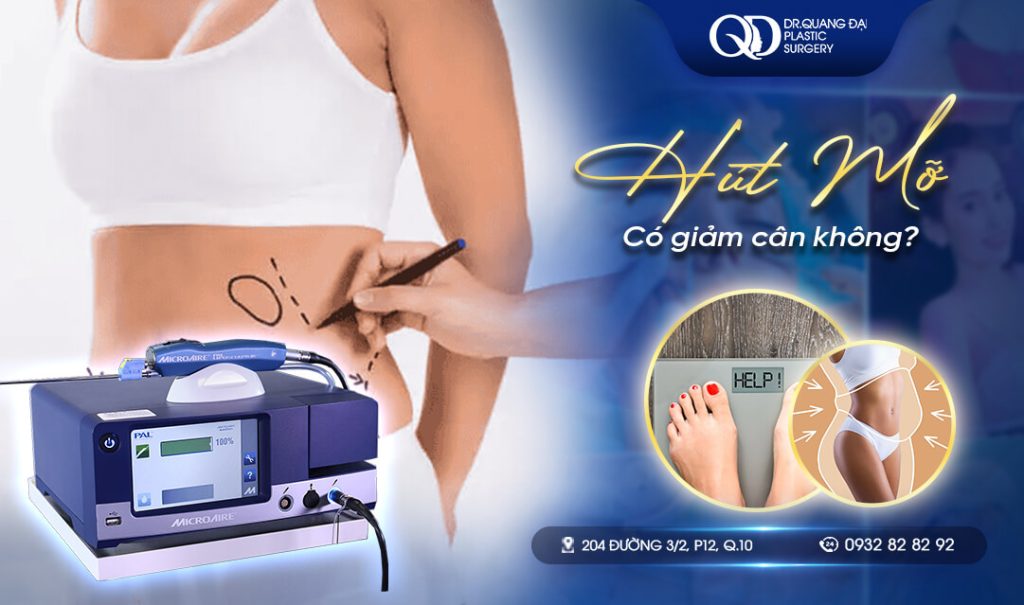 Hút mỡ có giảm cân không
