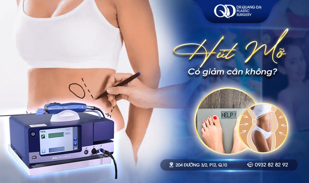 Hút mỡ có giảm cân không