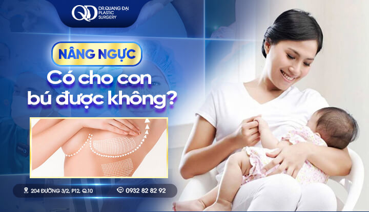 Nâng ngực có cho con bú được không