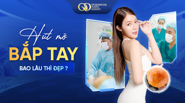hút mỡ bắp tay bao lâu thì đẹp