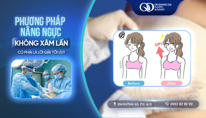 Phương pháp nâng ngực không xâm lấn