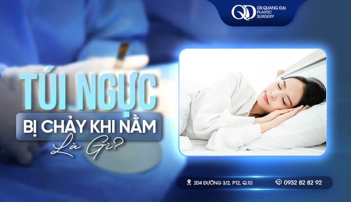 TÚI NGỰC BỊ CHẢY KHI NẰM - NGUYÊN NHÂN VÀ CÁCH KHẮC PHỤC