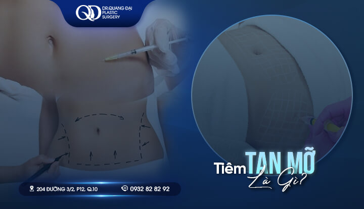 Tiêm tan mỡ là gì