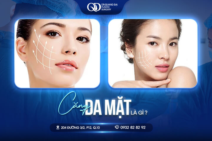 CĂNG DA MĂT LÀ GÌ