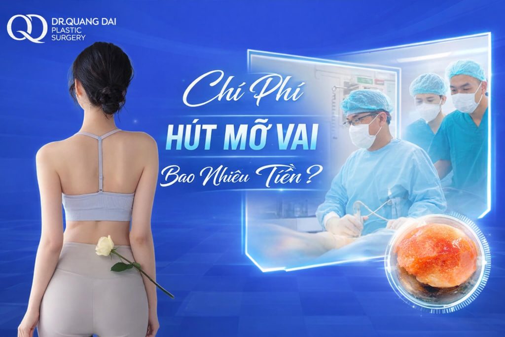 Chi phí hút mỡ vai bao nhiêu tiền