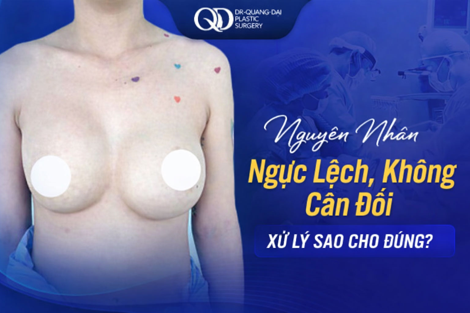 ngực không cân đối phải làm sao